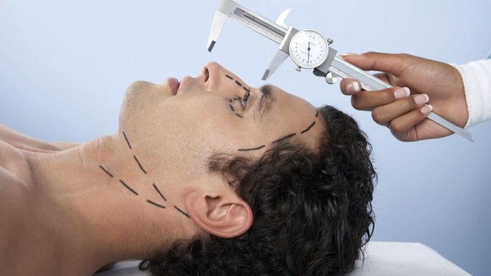 Мужчина у пластического хирурга