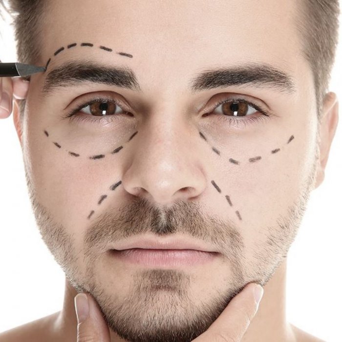 Мужские морщины