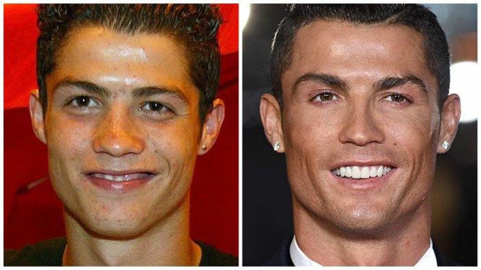 Кен Родриго до операций