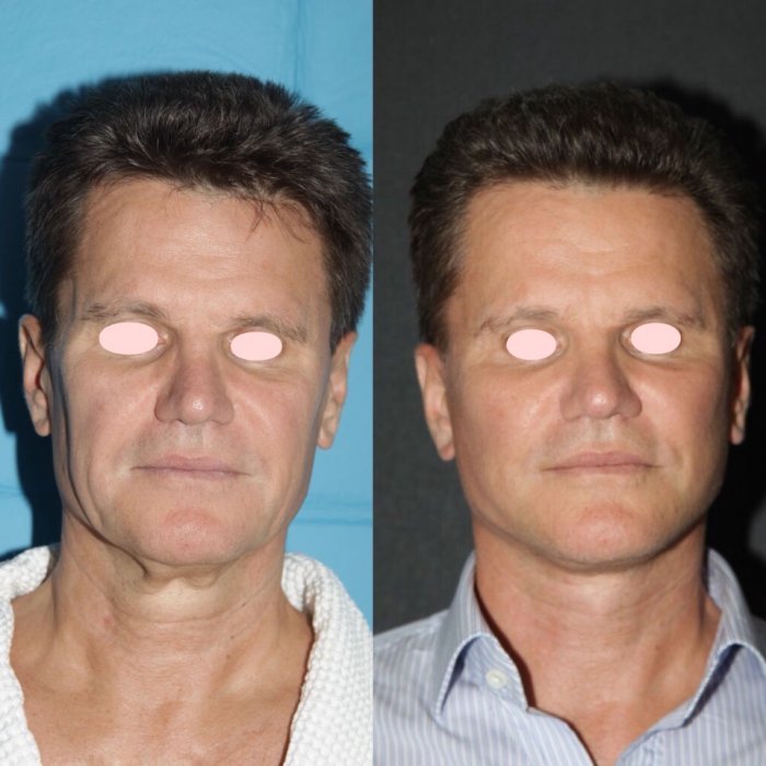 Пациент мужчина у косметолога