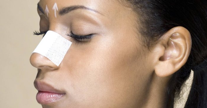 Ринопластика обои