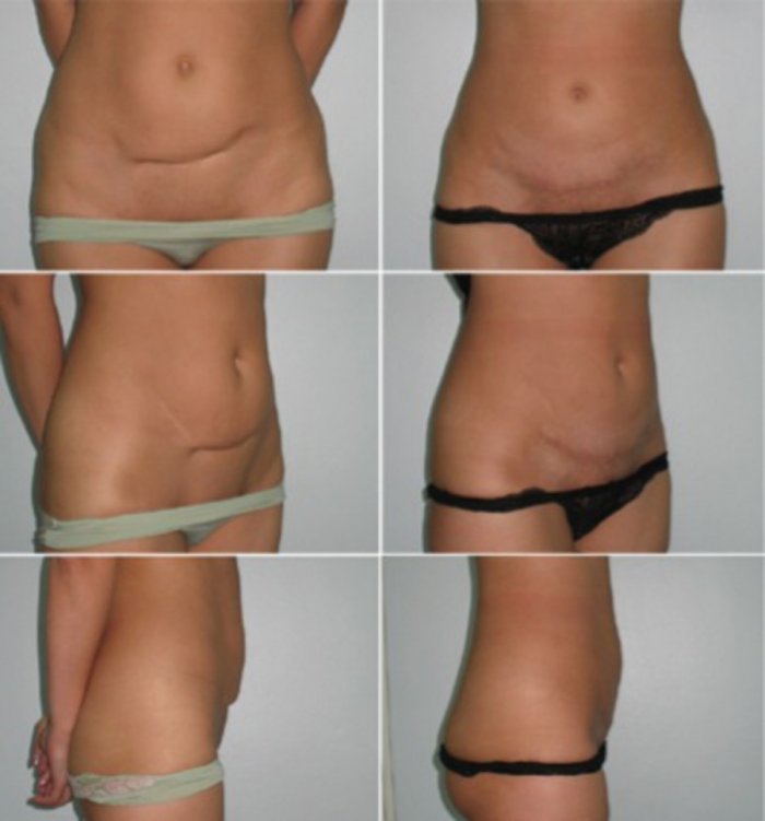 Пластика тела