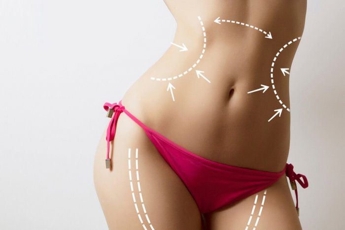 Абдоминопластика Ростов на Дону