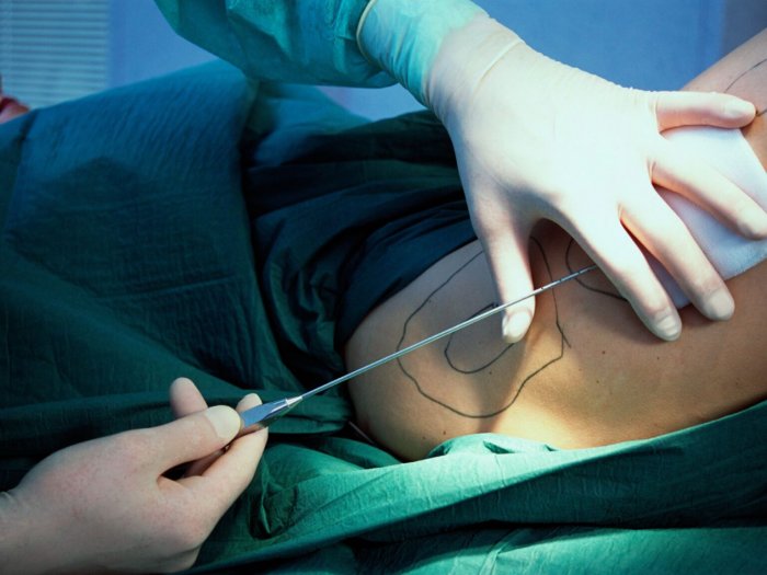 Живот косметология