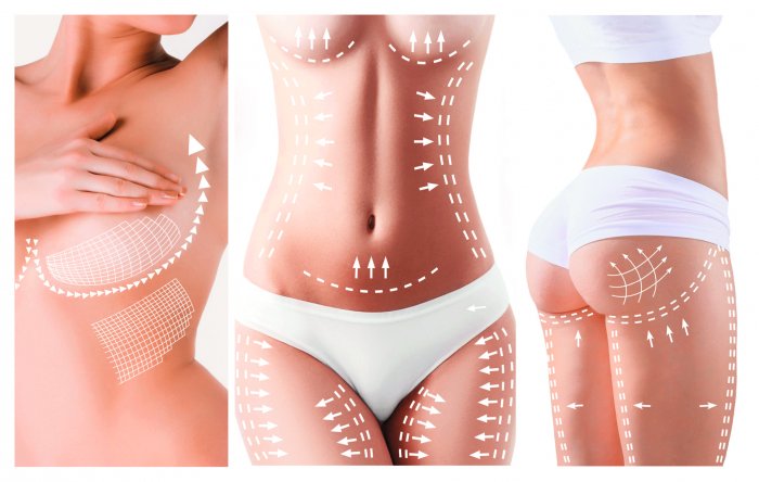 Пластика живота реклама