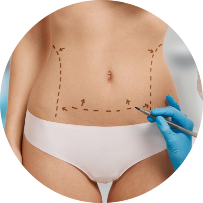 Пластическая хирургия липоскульптура