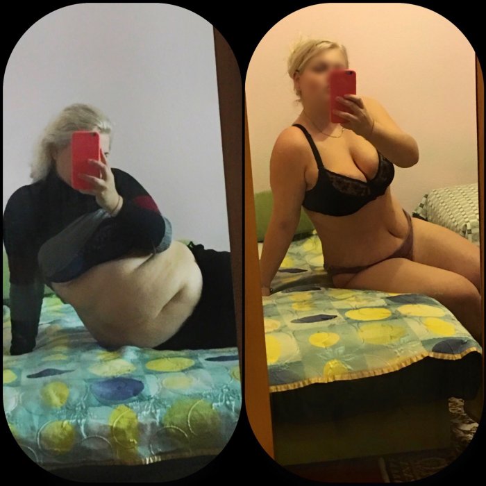 Липолитик инъекция самочувствие