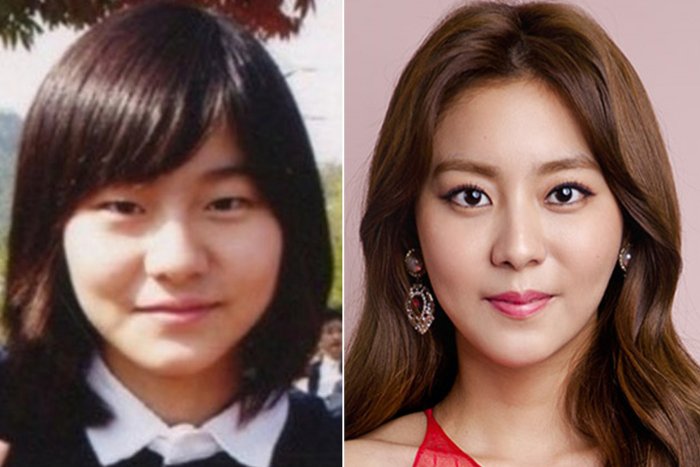 Айдолы до и после операции