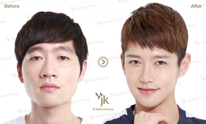 Республика Корея пластические операции