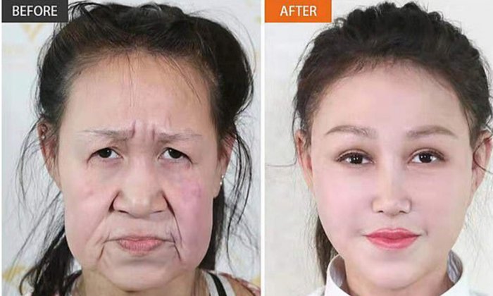 Сяо Фенг пластическая операция