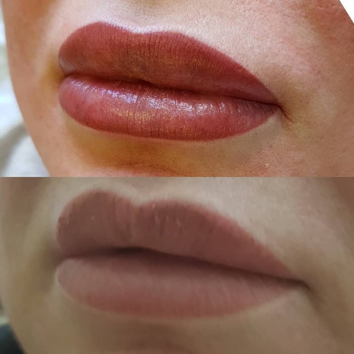 Шатуш на губах